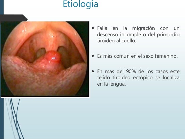Lengua Escrotal Ebook